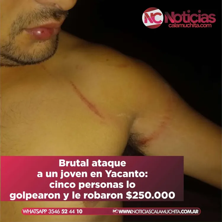 robo en yacanto